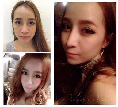 สวยครบแบบจัดเต็มร้อยไหมก้างปลาวีเชฟไม่จำกัดเส้นเพียง9900บาท แถม ฟรีโบท้อก50ยูนิต