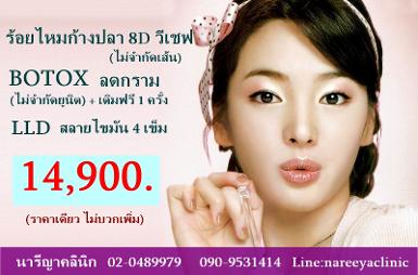 ร้อยไหมก้างปลาวีเชฟไม่จำกัดเส้น+โบท้อกกราม+สลายไขมัน4เข็ม14900